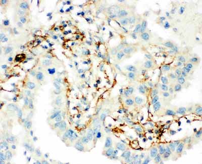 IHC - Anti-TGM2 Antibody ABO11464